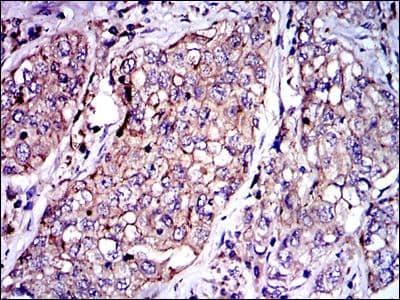 SERPINE1 / PAI-1 Antibody (clone 1D5)