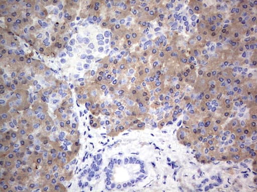 MTDH / Metadherin Antibody (aa70-582, clone OTI2F11)