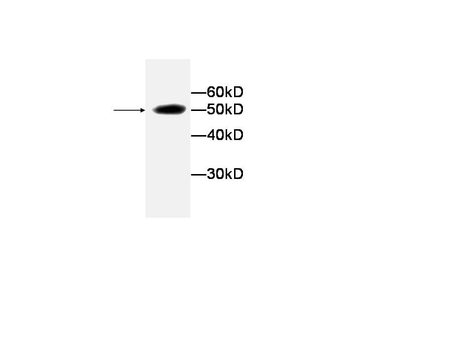 IHC-plus™ LDHA / LDH1 Antibody