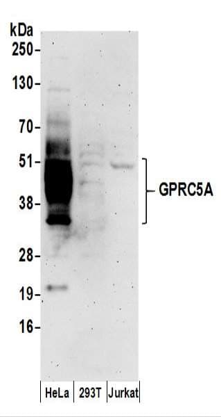 Polyclonal Rabbit anti-Human GPRC5A / RAI3 Antibody (aa307-357, WB)