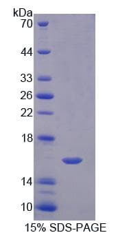 Human NRP1 / Neuropilin 1 Protein (Recombinant His)