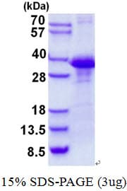 Human CLNS1A Protein (Recombinant His)