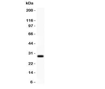 Beta Amyloid Antibody (aa672-702)