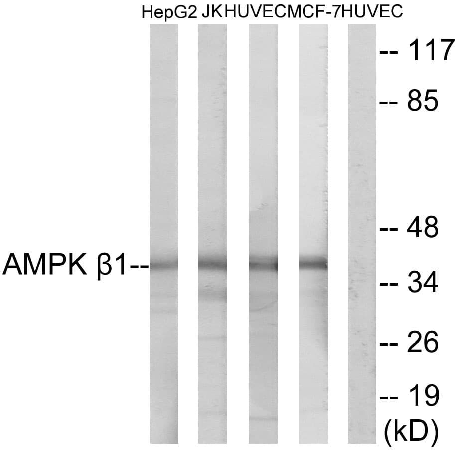 IHC-plus™ PRKAB1 / AMPK Beta 1 Antibody (aa147-196)