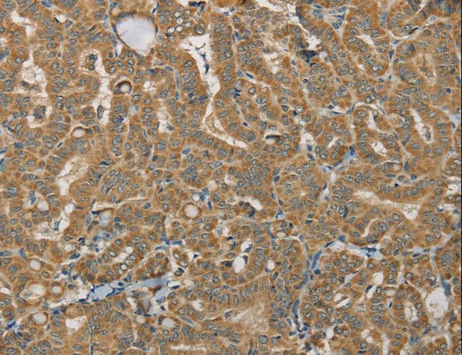 SDHB Antibody