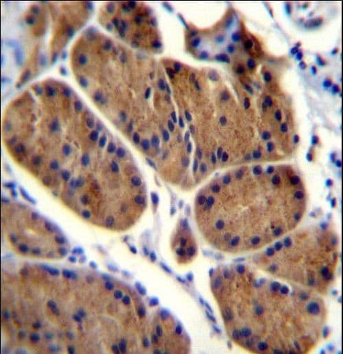 Polyclonal Rabbit anti-Human NDUFS8 Antibody (aa81-108, IHC, WB)