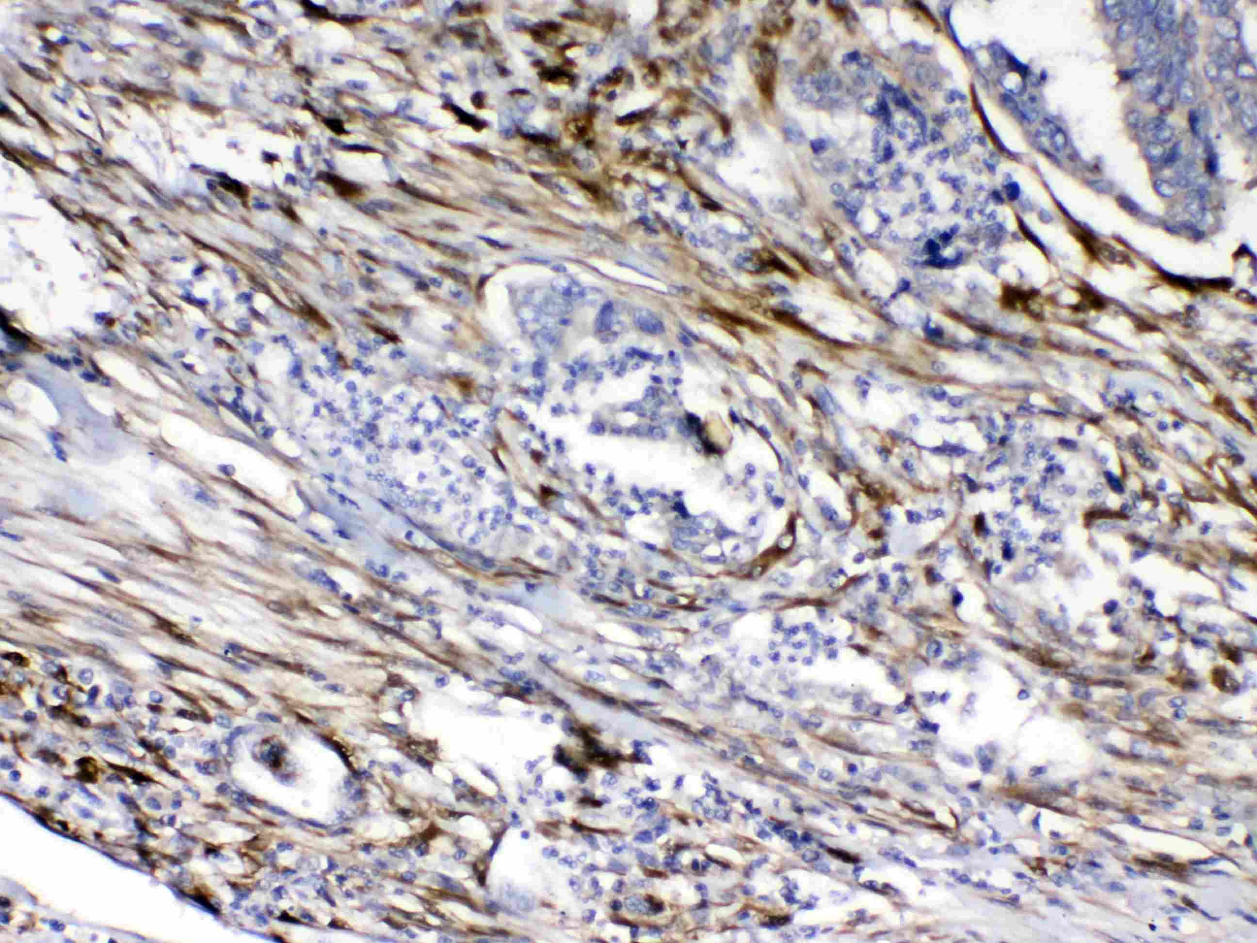 CYGB / Cytoglobin Antibody