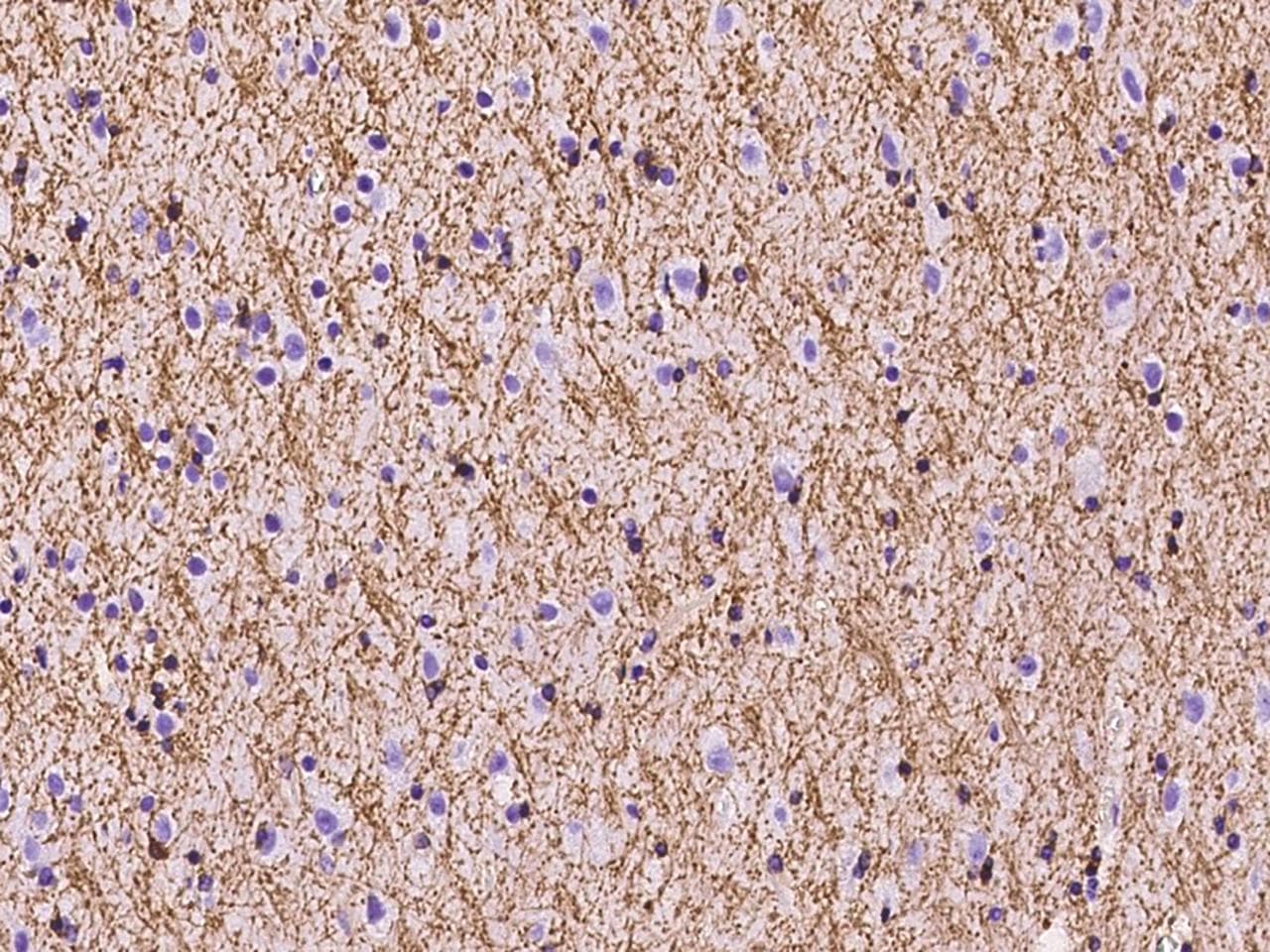 PLLP / Plasmolipin Antibody