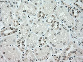 CHEK2 / CHK2 Antibody (clone OTI5C4)