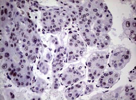 NBN / Nibrin Antibody (clone OTI6E11)