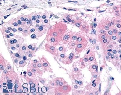 PathPlus™ GHSR / Ghrelin Receptor Antibody (N-Terminus)