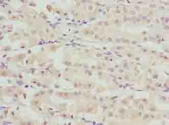 Polyclonal Rabbit anti-Human RIBC2 Antibody (IHC, WB)