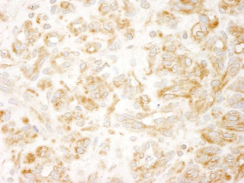 ZAK / MLTK Antibody (aa750-800)