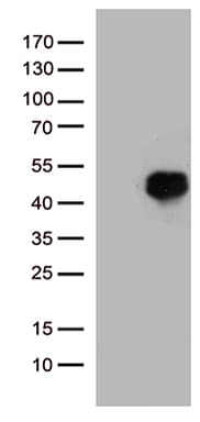 HOXD8 Antibody (aa69-290, clone OTI2A1, Carrier-free)