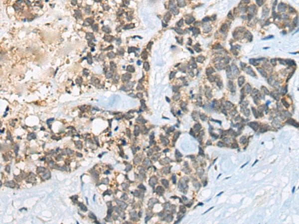 BACE2 Antibody