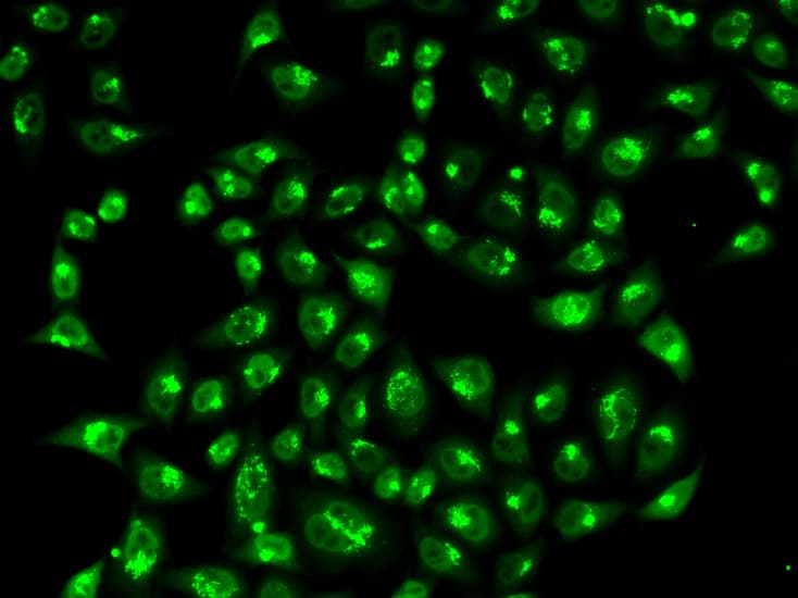 IHC-plus™ Polyclonal Rabbit anti-Human GOLGA2 / GM130 Antibody (IHC, IF, WB)