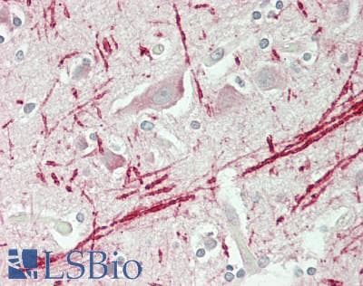 IHC-plus™ MAST205 / MAST2 Antibody (Internal)