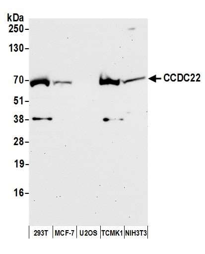 CCDC22 Antibody (aa577-627)