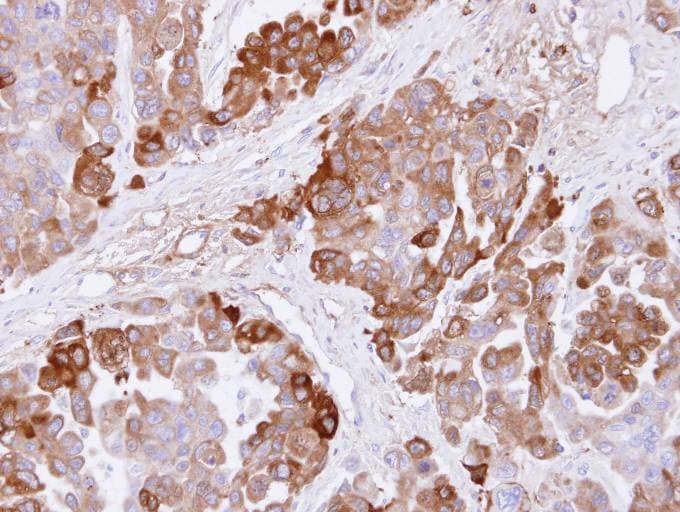 Polyclonal Rabbit anti-Human CBS Antibody (aa39-251, IHC, WB)