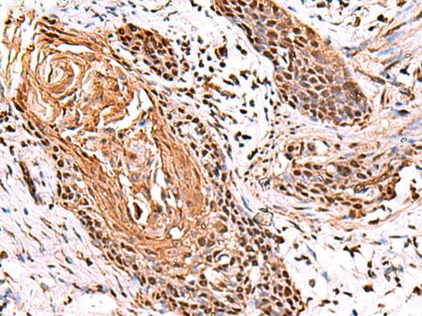 ITPR2 / IP3 Receptor Type 2 Antibody