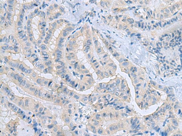 MSI2 Antibody