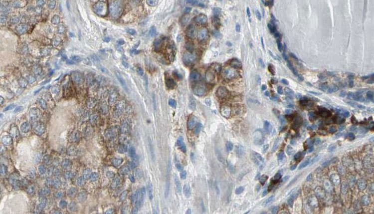 ALKBH7 Antibody