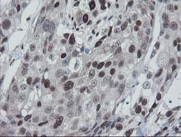 Monoclonal Mouse anti-Human TPRKB Antibody (clone OTI1E9, IHC, WB)