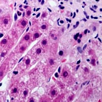 CYP21A2 Antibody (Internal)