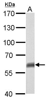 TP63 / p63 Antibody (aa125-415)