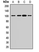 ADAM22 Antibody