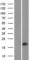 Human UBE2W Protein (Over-Expression Lysate Myc-DDK (Flag))