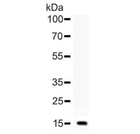 BTC / Betacellulin Antibody