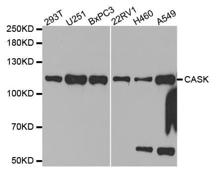 CASK Antibody
