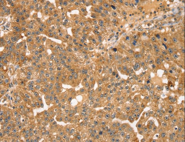 STX10 / Syntaxin 10 Antibody