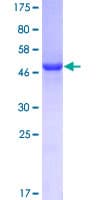 Human GSTO1 Protein (Recombinant GST)