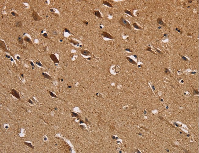 NDUFS1 Antibody