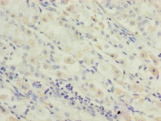 Polyclonal Rabbit anti-Human OXSM / KS Antibody (IHC)
