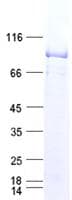 Human CD36 Protein (Recombinant His,C-terminus)