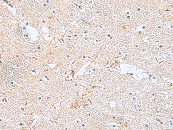 Polyclonal Rabbit anti-Human FAM107B Antibody (IHC)