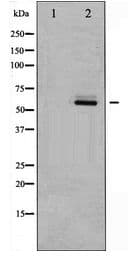 Polyclonal Rabbit anti-Human AKT2 Antibody (IHC, WB)
