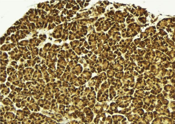 MED15 / ARC105 Antibody