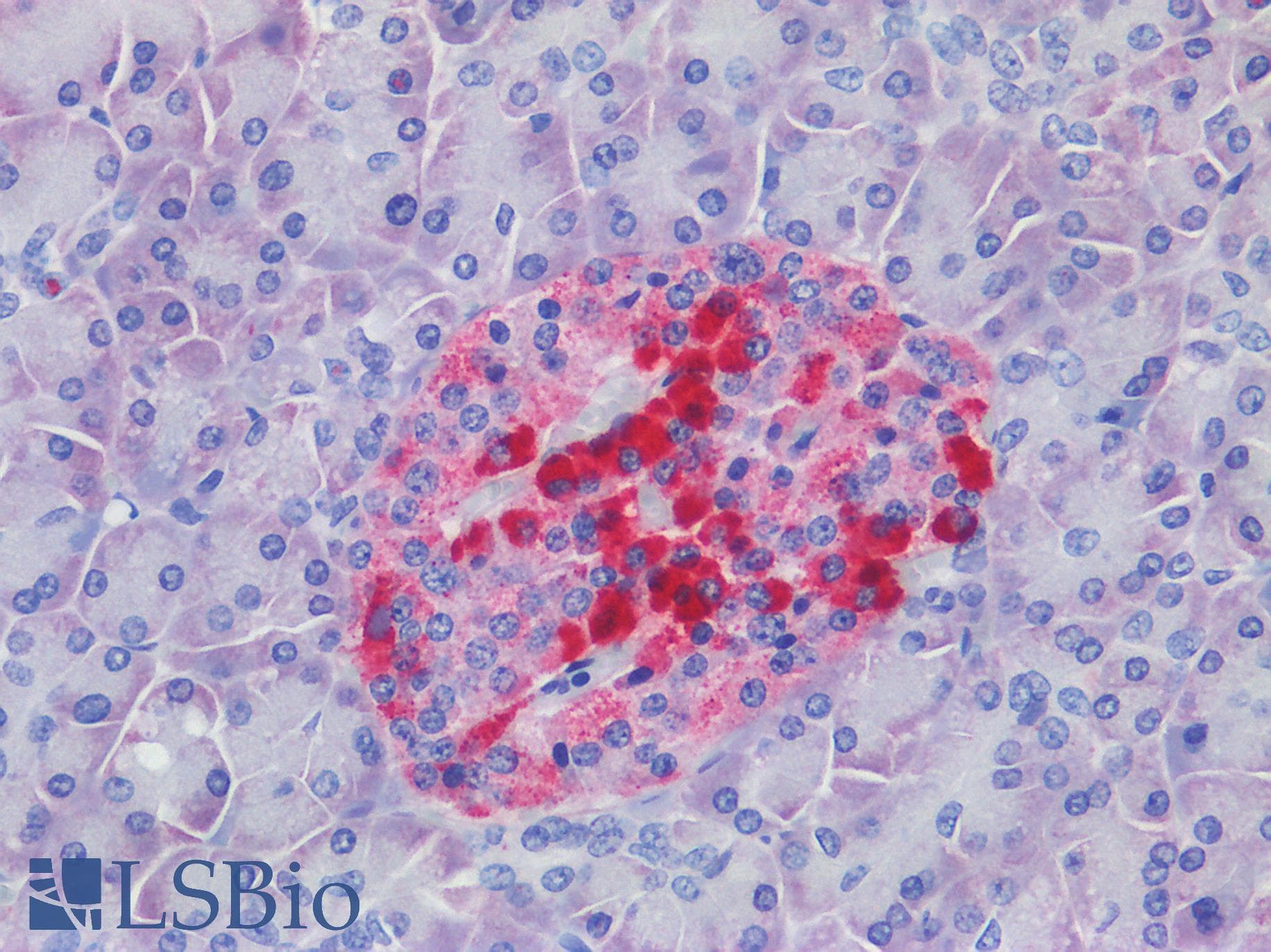 IHC-plus™ Polyclonal Rabbit anti-Human ATG16L1 / ATG16L Antibody (IHC, IF, WB)