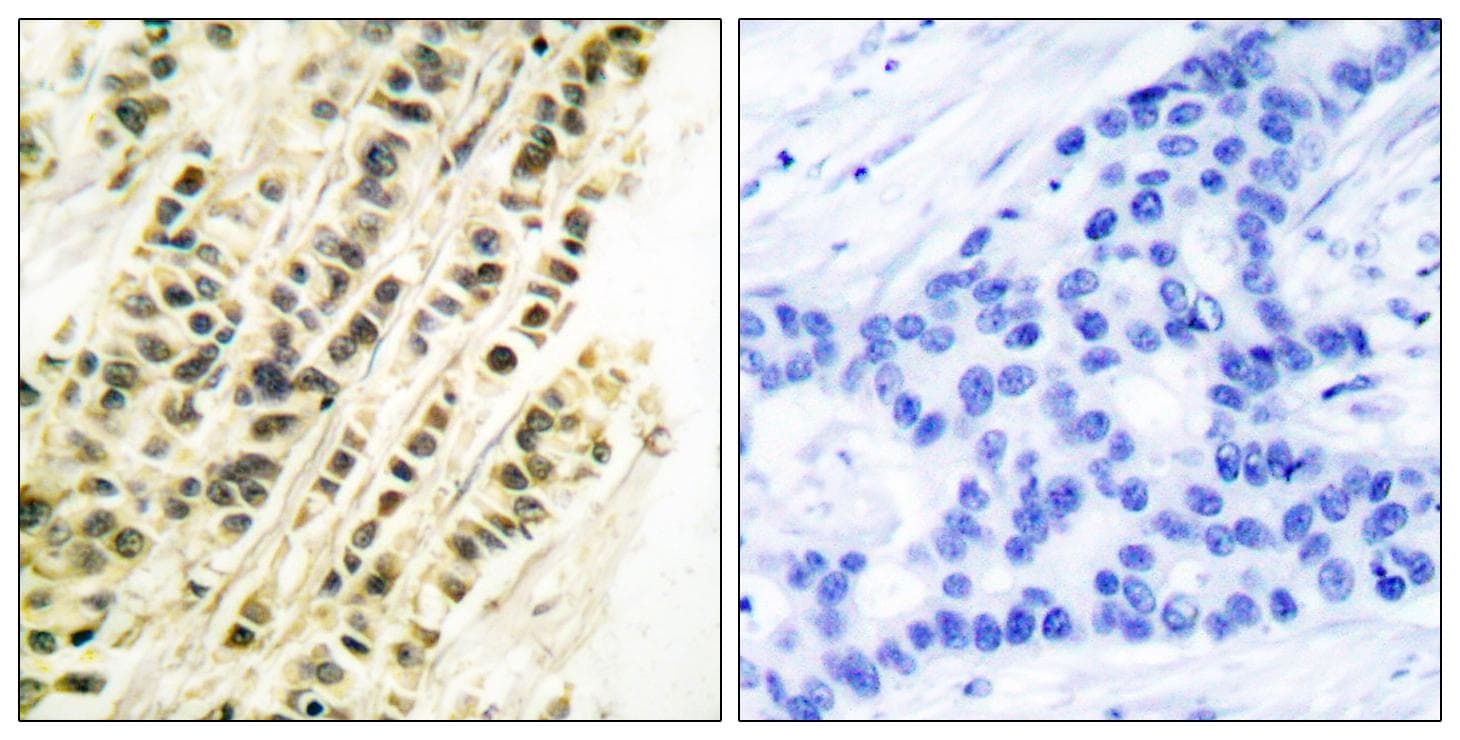 SRF / Serum Response Factor Antibody (p99)
