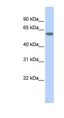NR1A2 / THRB Antibody (N-Terminus)