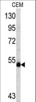 IHC-plus™ Polyclonal Rabbit anti-Human MYCN / N-myc Antibody (aa322-351, IHC, WB)