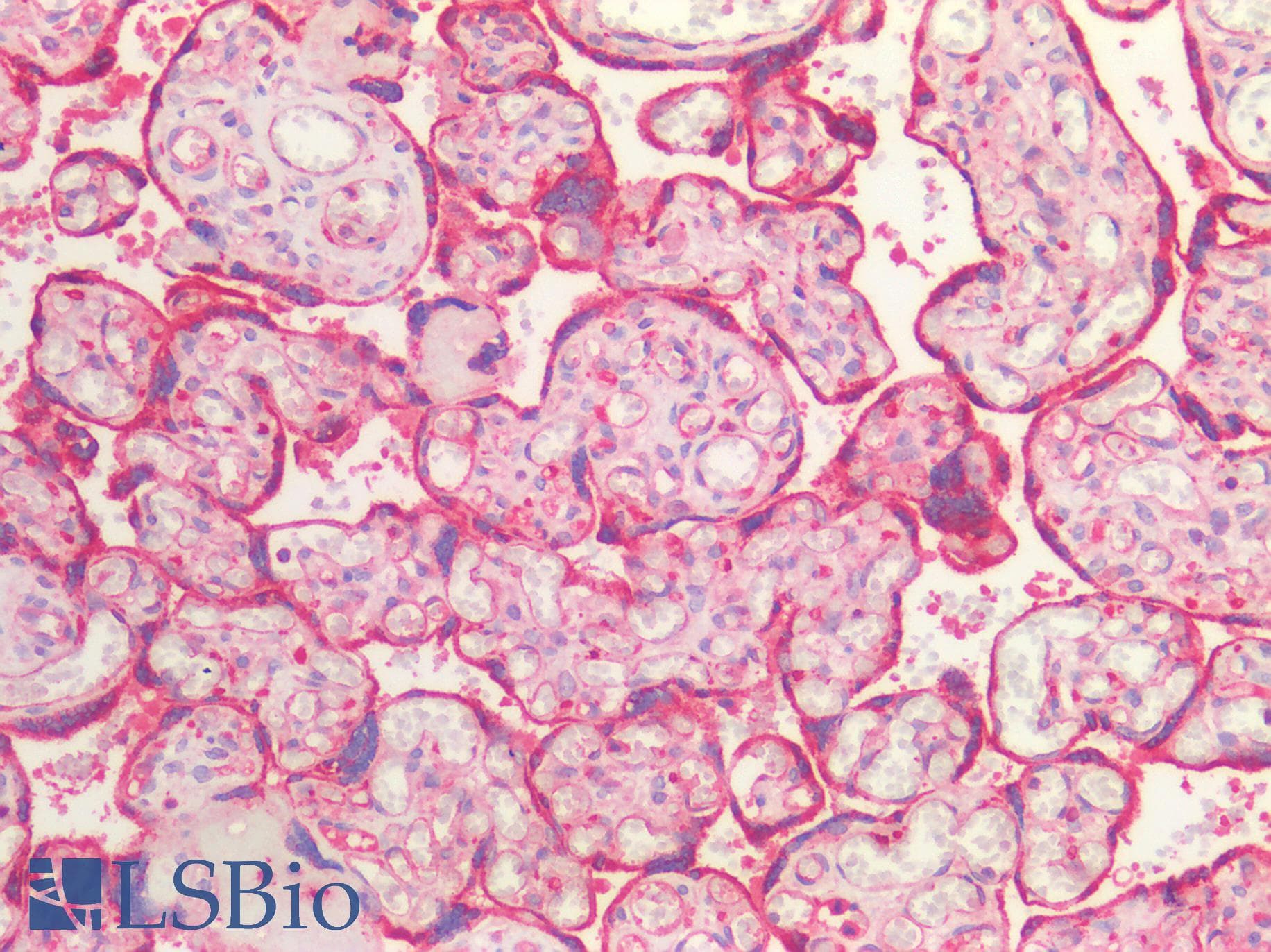 IHC-plus™ ACVR2 / ACVR2A Antibody (aa20-140)