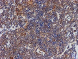 ATRIP Antibody (clone OTI5E7)