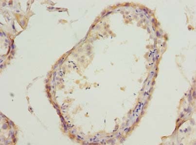 WDR61 Antibody