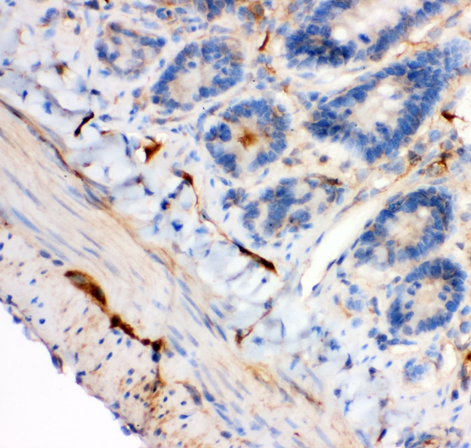 IRS1 Antibody (aa1041-1242)