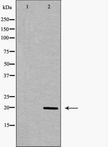 MLC2 / MYL9 Antibody